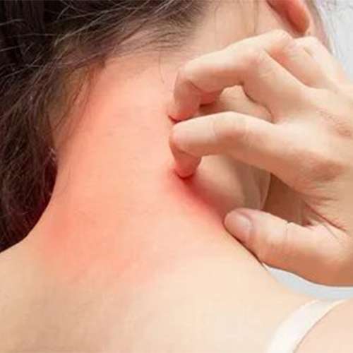 itchy skin, eczema treatment in Lahore, best skin specialist in Lahore