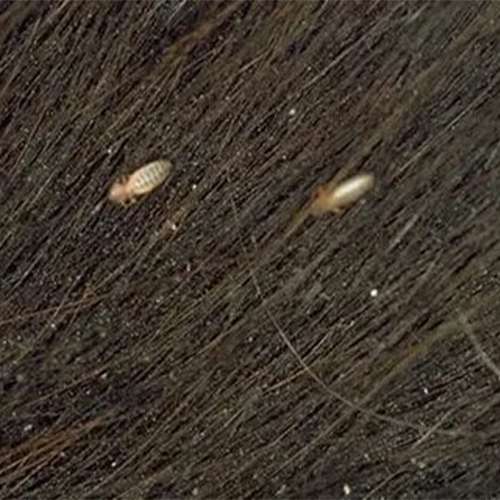 lice faces treatment in Lahore, headlice treatment in Lahore